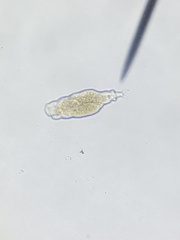 Bdelloidea