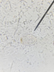 Euglypha