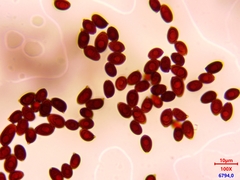 Leucoagaricus carneifolius