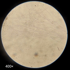 Bacteria