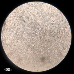 Bacteria
