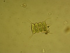 Scenedesmus quadricauda
