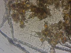 Chaenotheca hispidula