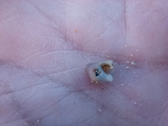 Gastropoda