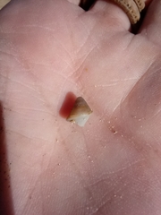 Gastropoda