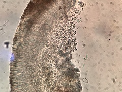 Lecidea erythrophaea
