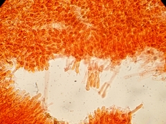 Arrhenia rickenii