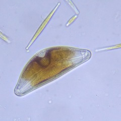 Cymbella
