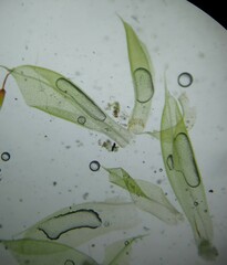 Funaria hygrometrica