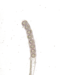 Lamprospora tortulae-ruralis