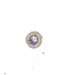 Lamprospora tortulae-ruralis