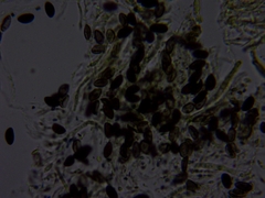 Xylaria corniformis