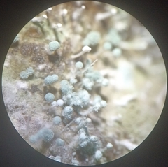 Aspergillus