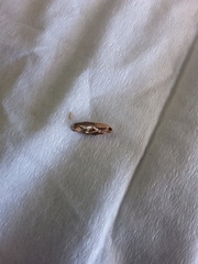 Epiphyas postvittana