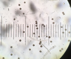 Disciseda subterranea