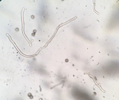 Disciseda subterranea