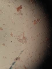 Saccharomyces cerevisiae