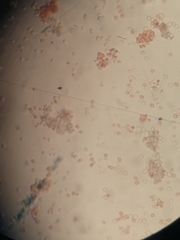 Saccharomyces cerevisiae