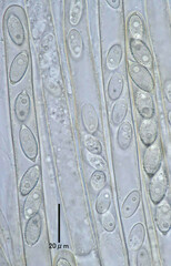 Phaeopezia apiculata