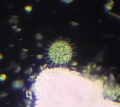Pseudopediastrum boryanum longicorne
