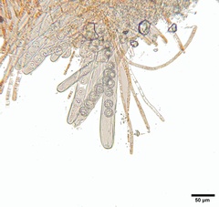 Lamprospora feurichiana