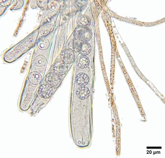 Lamprospora feurichiana