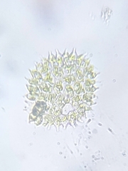 Pseudopediastrum boryanum