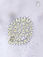Pseudopediastrum boryanum