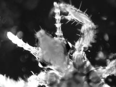 Pediculus humanus capitis