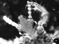 Pediculus humanus capitis