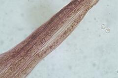 Cribraria microcarpa