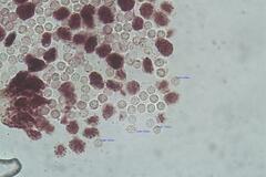 Cribraria microcarpa