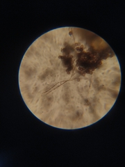 Diderma montanum