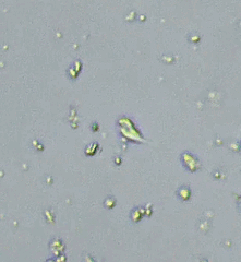 Cercozoa