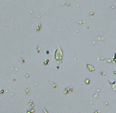 Cercozoa