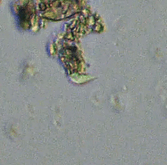 Cercozoa
