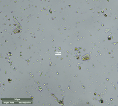 Cercozoa