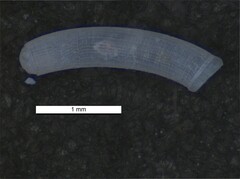 Caecum venosum
