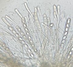 Trichophaea woolhopeia