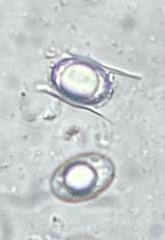 Trichophaea woolhopeia