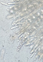 Trichophaea woolhopeia