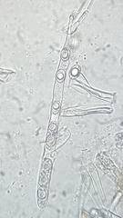 Trichophaea woolhopeia