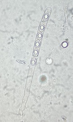 Trichophaea woolhopeia