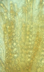 Trichophaea woolhopeia