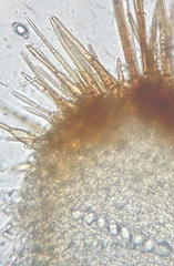 Trichophaea woolhopeia