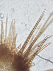 Trichophaea woolhopeia