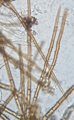 Trichophaea woolhopeia