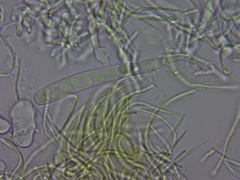 Ascobolus lignatilis