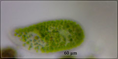 Paramecium bursaria