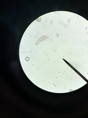 Gastrotricha